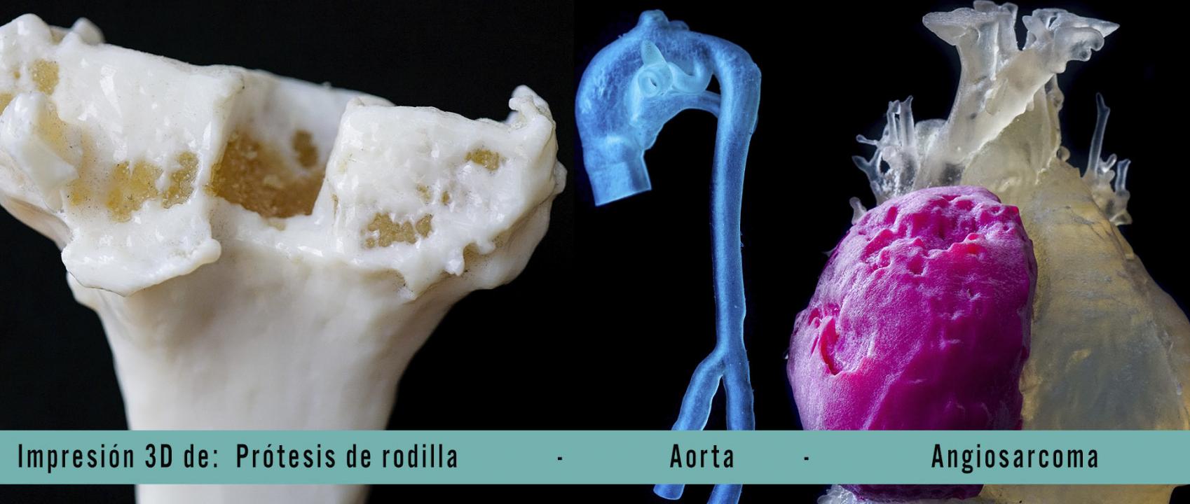 impresión 3D