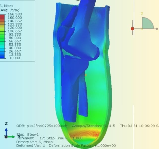 Innovación con impacto social y militar: proyectos de prótesis y escoliosis son aceptados para presentaciones orales en Roma 2025
